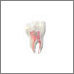 Root Canals